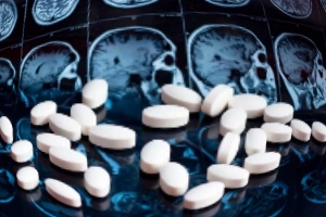 Clonazepam
